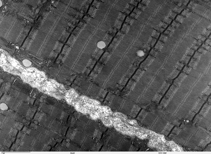 Skeletal muscles appear to have ‘stripes’ of fibres when seen under the microscope.  This transmission electron microscope image shows human skeletal muscle fibres close up.  The banding patterns visible here results from overlapping strands of actin and myosin proteins.  Where the actin fibres overlap, they show up as the dark lines under the electron beam, known as Z lines.  In plainfin midshipman singing males, the sonic muscle actin fibres overlap more, giving these fibres their unusually high tensile strength, and making the Z lines unusually wide and pronounced (Image: Wikimedia Commons)