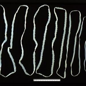 An adult beef tapeworm (Taenia saginata) from a human gut (Image: Wikimedia Commons)