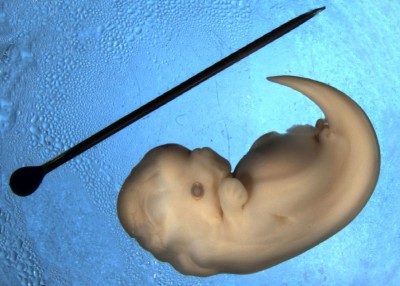 Dolphin embryo (Image: Wikimedia Commons)