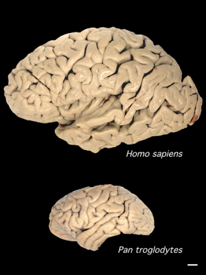 Comparison of human (above) and chimpanzee brain sizes (Image: Wikimedia Commons)