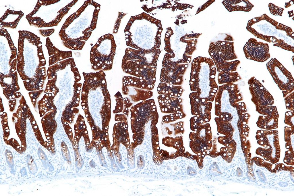 A thin section of the small intestine wall, stained for CK20 protein (found in the mucosal lining).   The lining of our intestines is a vast sensory surface, whose cells are nourished by fatty acids, vitamins and other compounds produced by bacterial fermentation.  The finger-like projections (called villi) visible in this section, form our main absorptive surface for nutrients, and sense the presence of both friendly bacteria and harmful pathogens (Image: Wikimedia Commons)