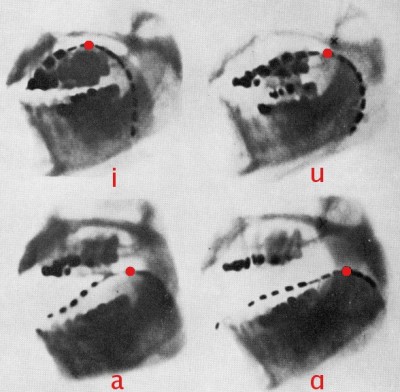 X-rays of a human jaw, taken by Dr H. Trevelyan George at St. Bartholomew's Hospital, London, in January, 1917.  The black dashed line in these x-rays is a thin metal chain on the tongue’s upper surface.  The pictures reveal how it changes position when producing the ‘cardinal’ vowels [i, u, a, ɑ].  These sounds are voiced by controlling the flow of breath and causing vibrations in the vocal cords.   English consonants are voiced or voiceless, and are made using five main movements.  We touch the lips together or against the teeth, place the tongue between or onto the back of the teeth, or against the hard palate, and lift the tongue against the soft palate.  We also use an open-mouthed turbulent flow of air to make aspirated sounds as in the ‘h’ of ‘hair’ (Image: Wikimedia Commons)