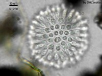 Sphaeroeca, a colony of choanoflagellates (approx. 230 individuals), in light microscopy (Image: D.H. Zanette via Wikimedia Commons)